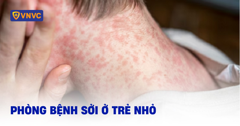 phòng tránh bệnh sởi ở trẻ