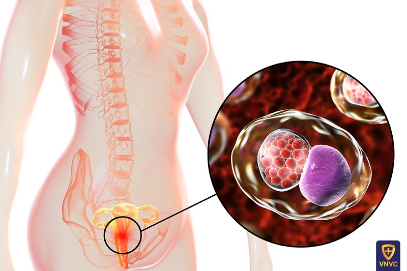 Bệnh do Chlamydia: Nguyên nhân, triệu chứng, điều trị và cách phòng ngừa