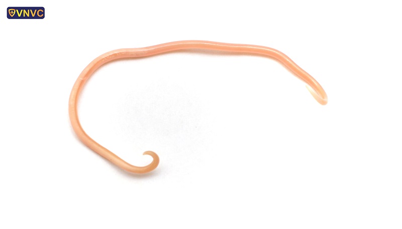 Nhấn vào ảnh để phóng to nhiễm giun