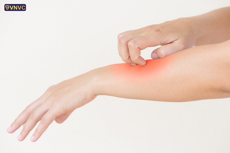 điều trị khi bị ban da