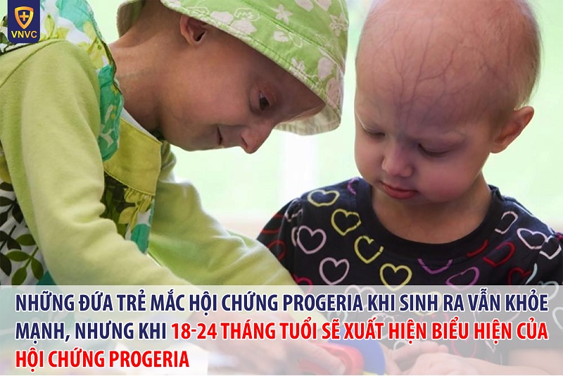 Hội chứng Progeria: nguyên nhân, triệu chứng, điều trị