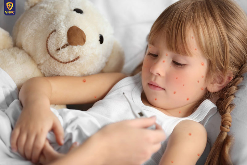 bien chung thuy dau o tre