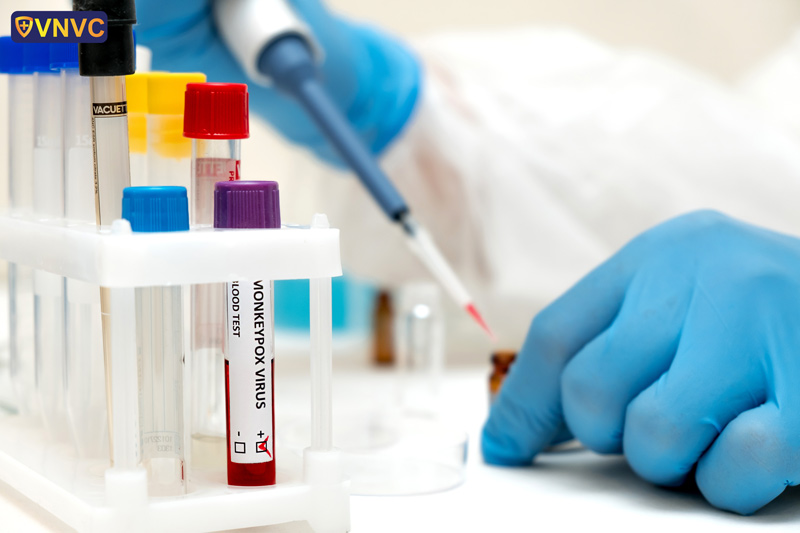 xét nghiệm đậu mùa khỉ