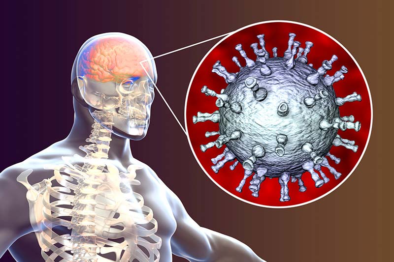 bệnh thủy đậu gây viêm não