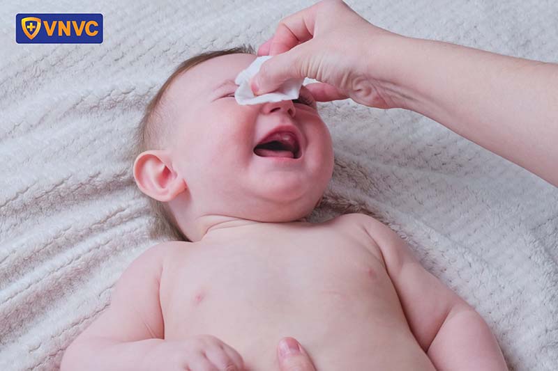 vệ sinh giời leo ở mắt