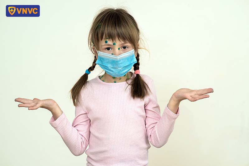 đeo khẩu trang khi bị phỏng dạ