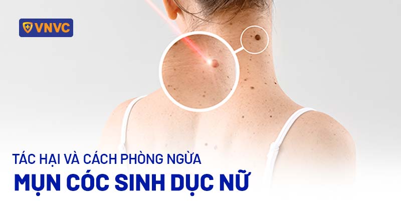 mụn cóc sinh dục nữ