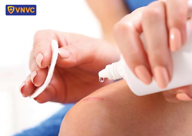 vệ sinh vết chó cắn