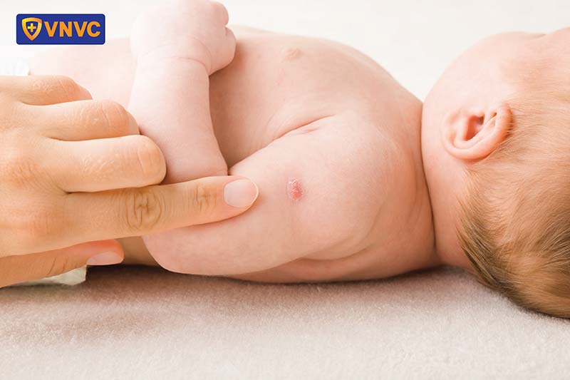 tác dụng phụ vắc xin bạch hầu