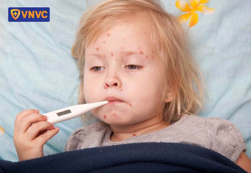 Trẻ em đang mắc các bệnh mùa hè