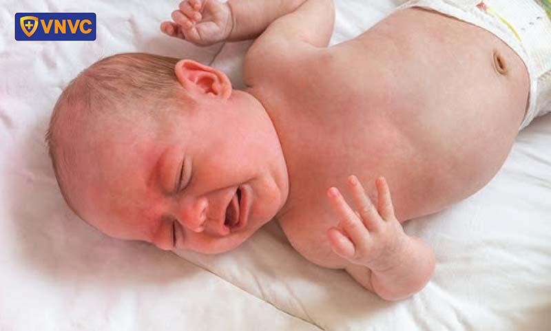 uốn ván rốn ở trẻ sơ sinh