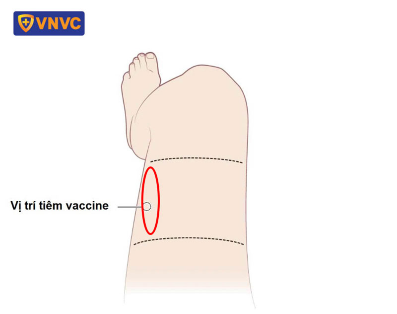 vị trí tiêm vắc xin ở vùng đùi