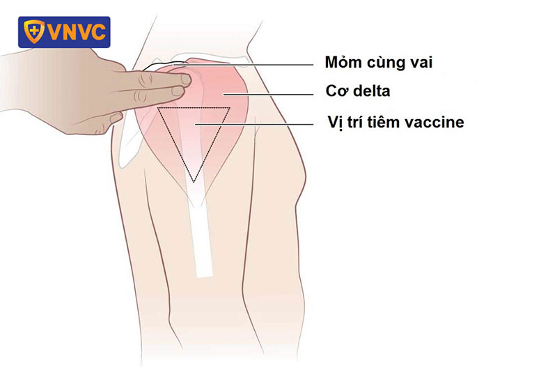 vị trí tiêp vắc xin ở bắp tay