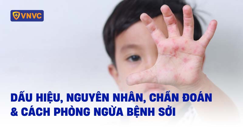Nhấn vào ảnh để phóng to bệnh sởi