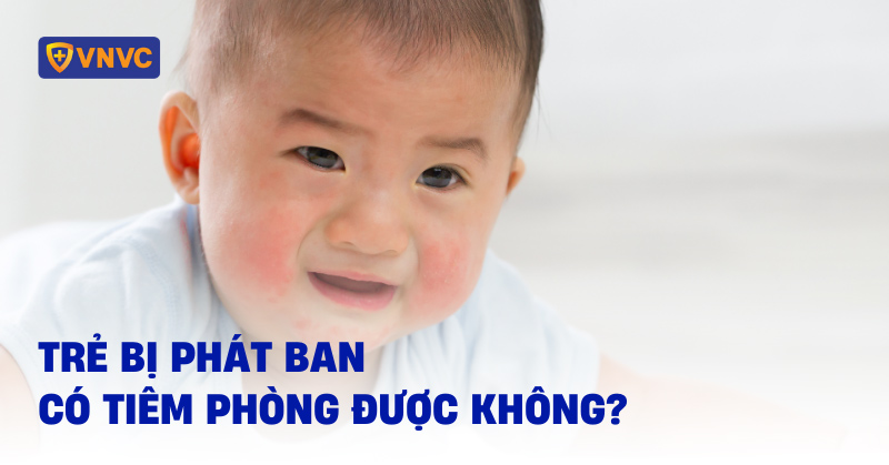 trẻ bị phát ban có tiêm phòng được không