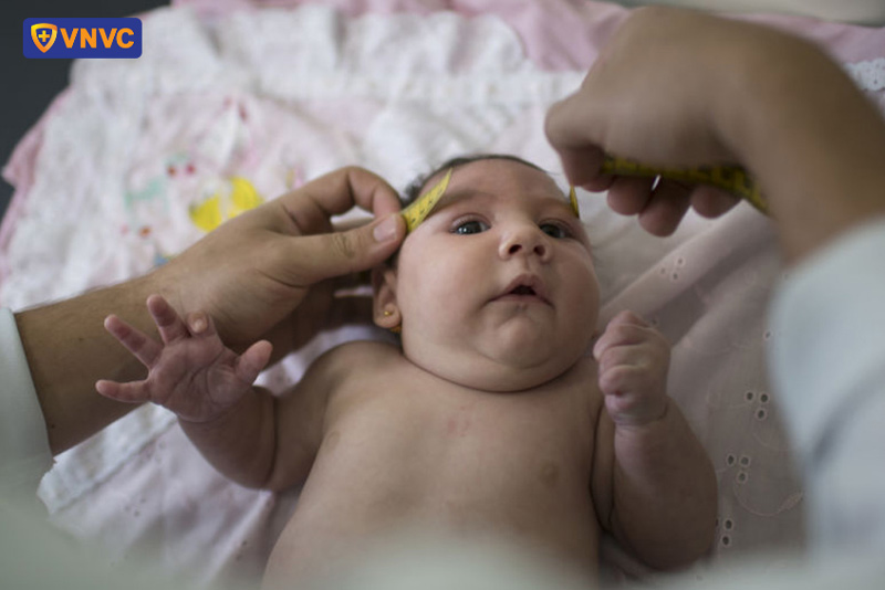 trẻ nhiễm virus zika