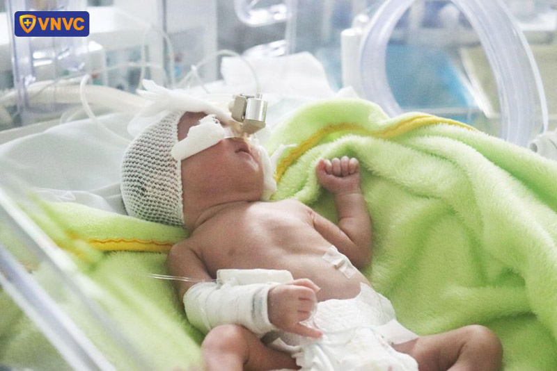 trẻ sinh non dễ mắc bệnh