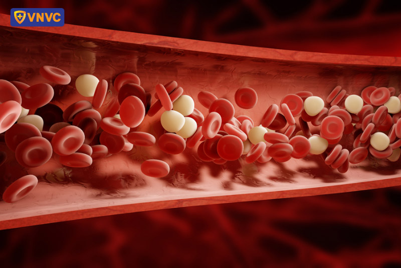 hiện tượng phù nề tay chân do sốt xuất huyết