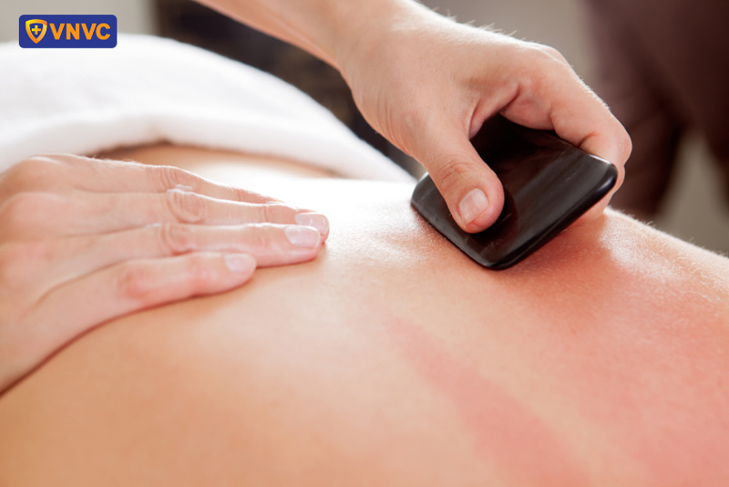 sốt xuất huyết có được cạo gió không