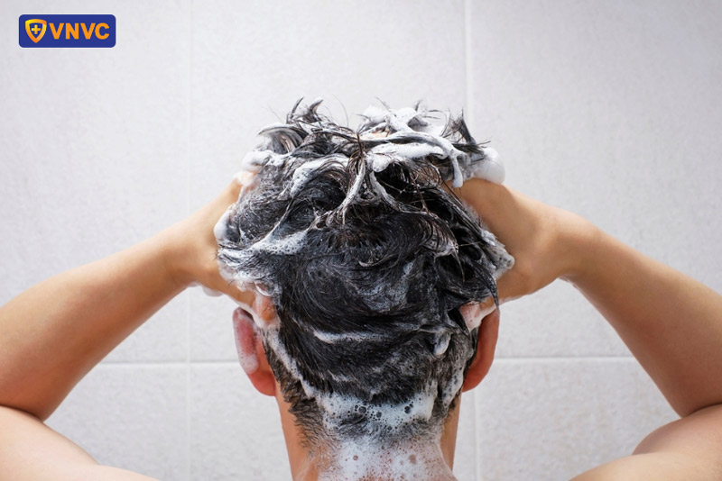 sốt xuất huyết có được gội đầu không