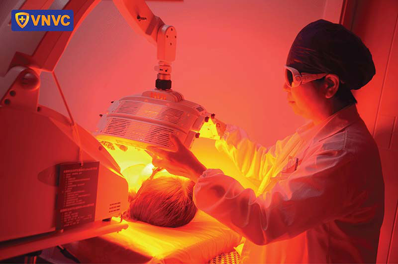 trị sùi mào gà bằng ALA PDT