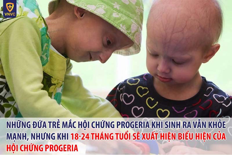 hội chứng progeria