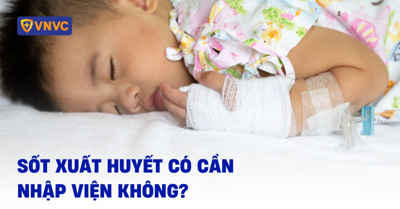 sốt xuất huyết có cần nhập viện không