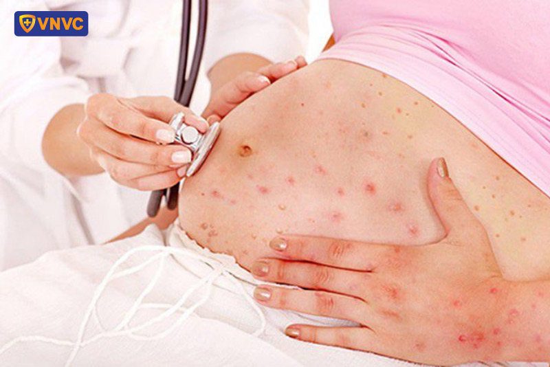 zona thần kinh có ảnh hưởng đến thai nhi không