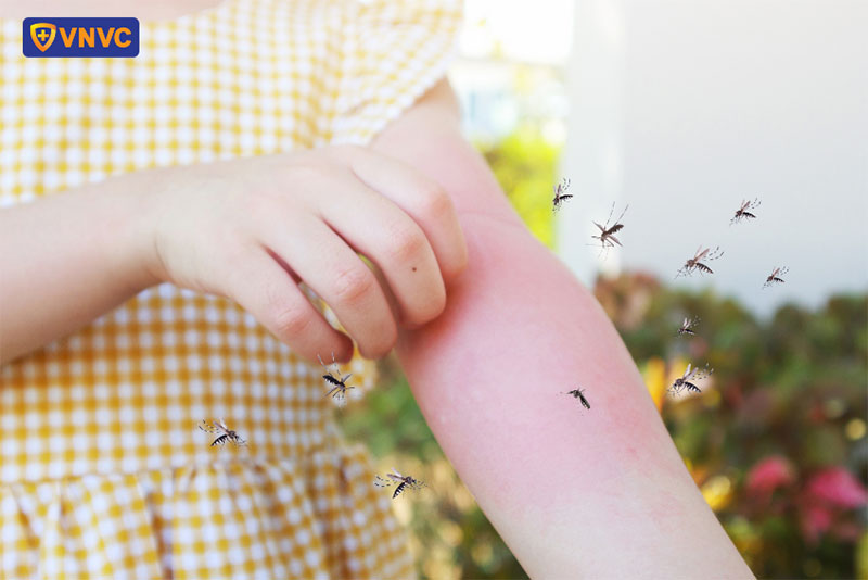 bệnh sốt xuất huyết