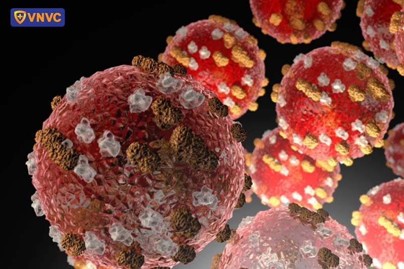 virus sởi