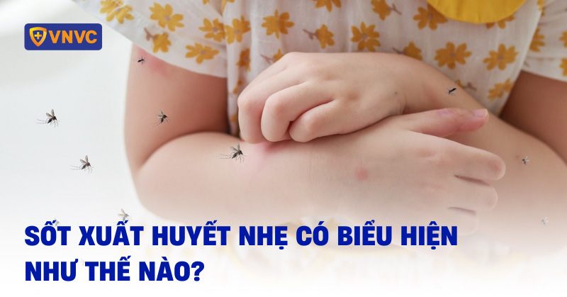 biểu hiện sốt xuất huyết nhẹ