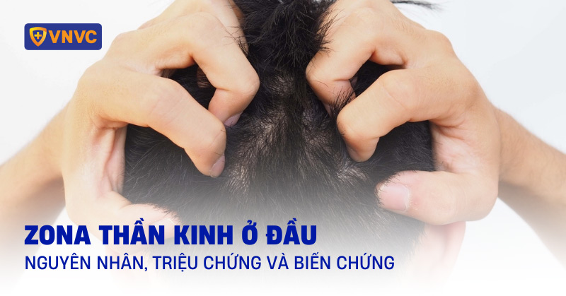 zona thần kinh ở đầu