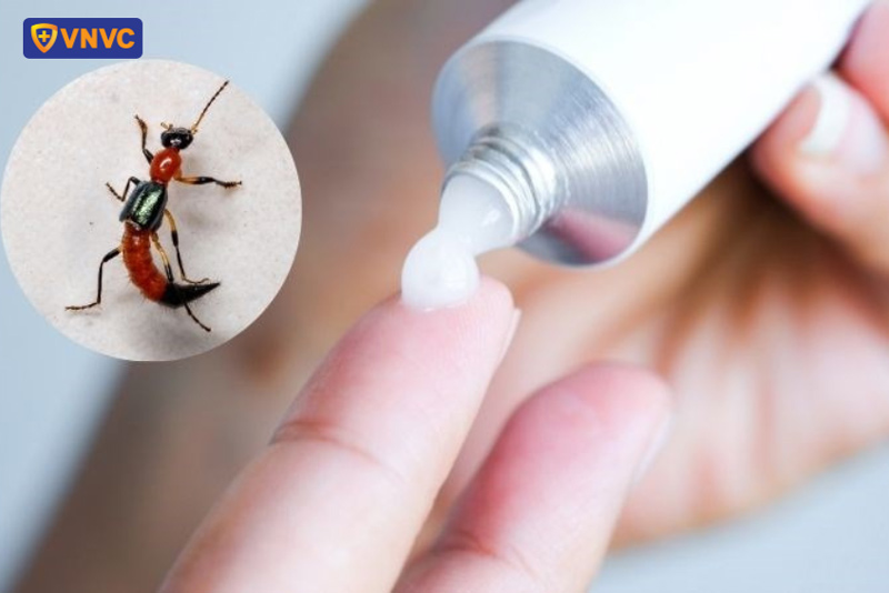 thuốc bôi trị côn trùng cắn