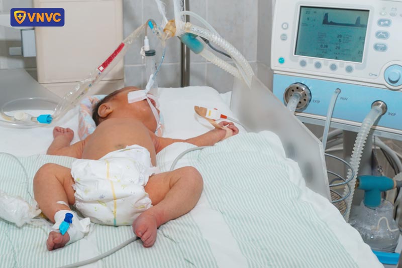bé sơ sinh mắc não mô cầu