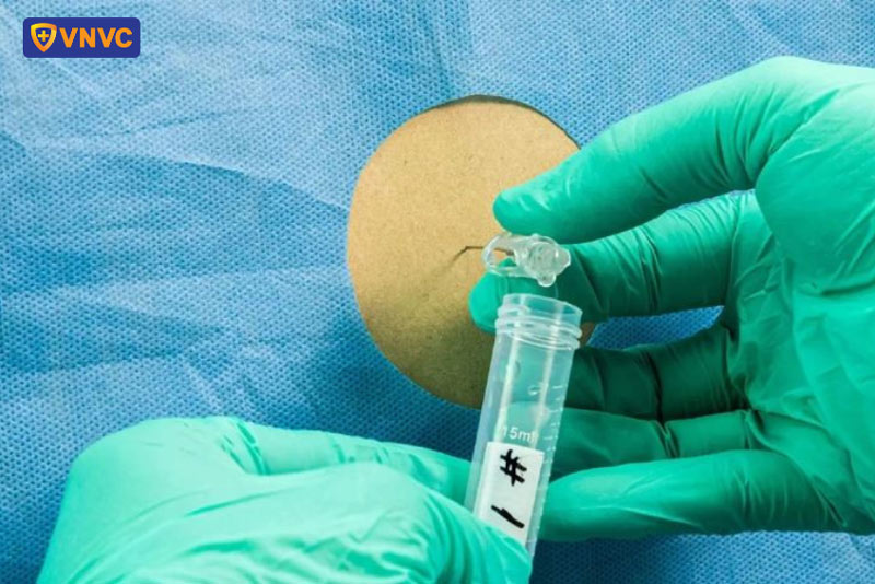 chẩn đoán tay chân miệng độ 4