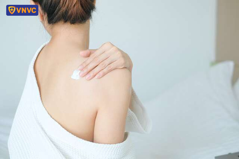 giảm ngứa do sốt xuất huyết