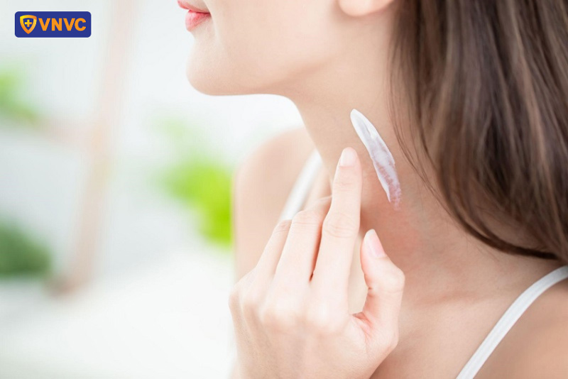 giảm ngứa khi bị sốt xuất huyết