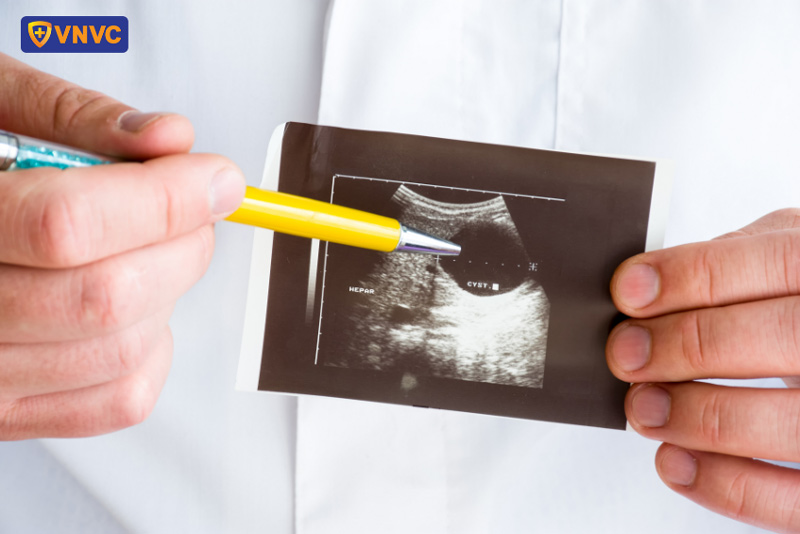 hình ảnh siêu âm gan