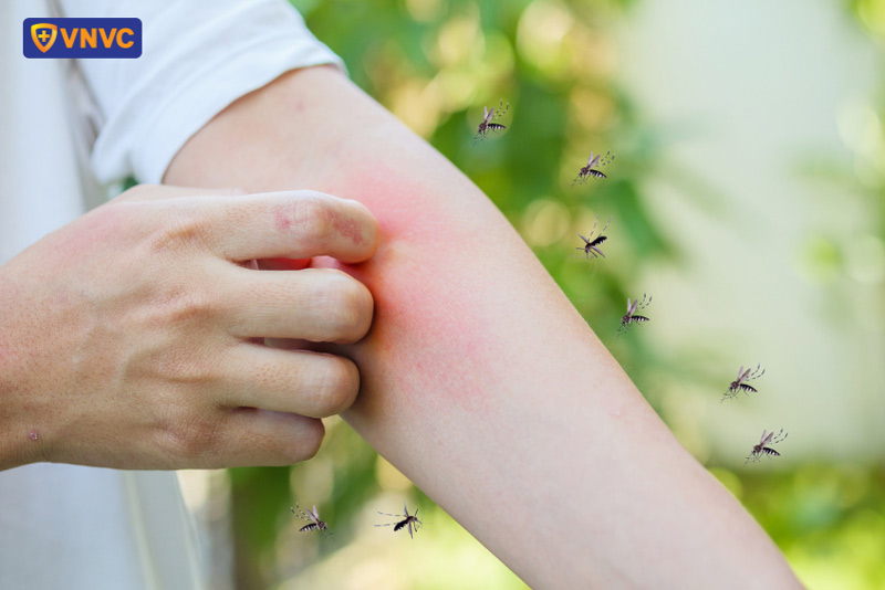 muỗi chích gây bệnh sốt xuất huyết