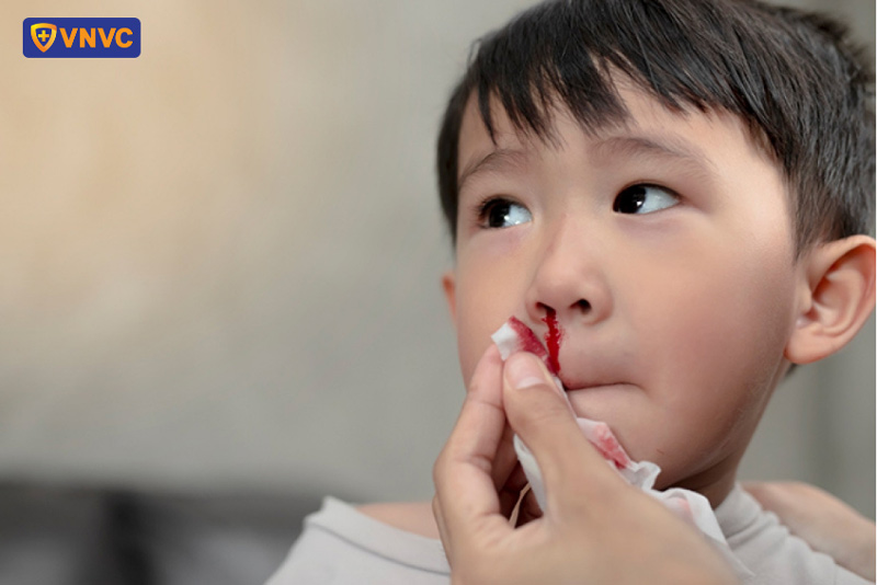 sốt xuất huyết bị chảy máu mũi