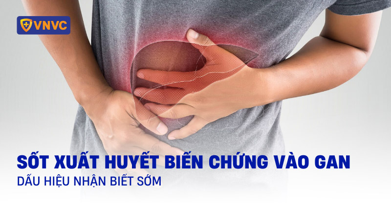 sốt xuất huyết biến chứng vào gan