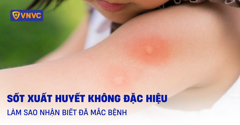 sốt xuất huyết không đặc hiệu