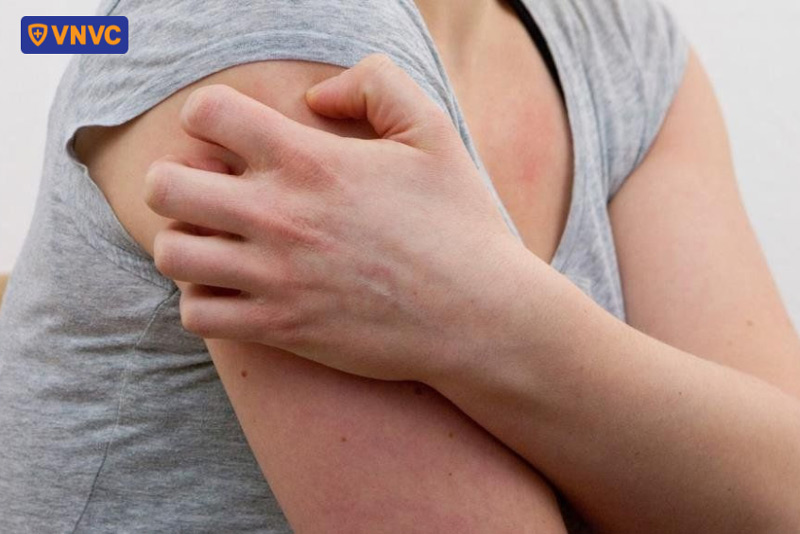 bệnh nhân tiểu đường bị zona