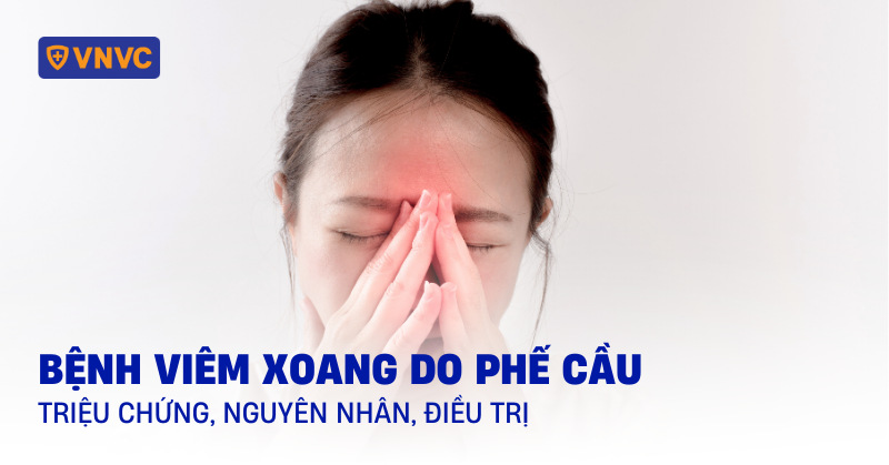 Bệnh viêm xoang do phế cầu: Triệu chứng, nguyên nhân, điều trị