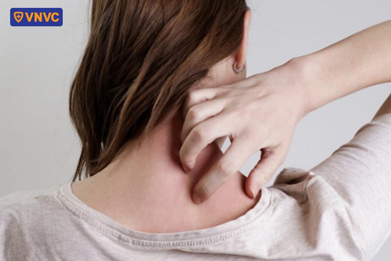 cảm giác đau ngứa khi bị zona