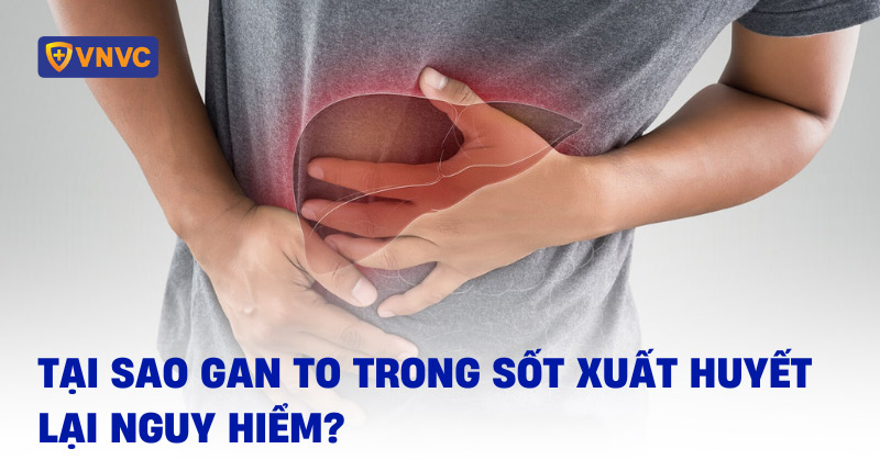gan to trong sốt xuất huyết