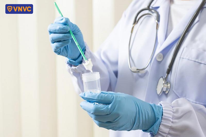 kiểm tra xét nghiệm hpv