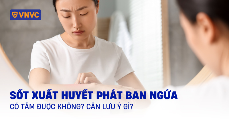 sốt xuất huyết phát ban ngứa có tắm được không