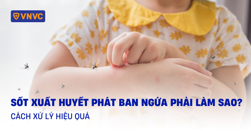sốt xuất huyết phát ban ngứa phải làm sao