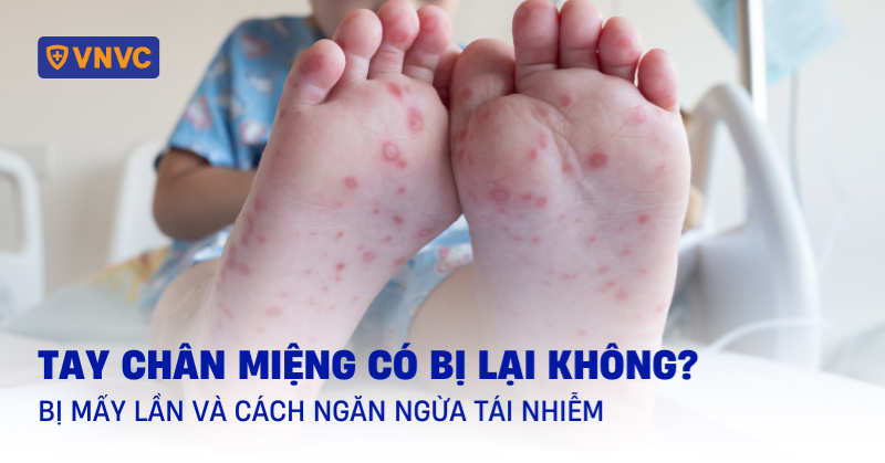 tay chân miệng có bị lại không